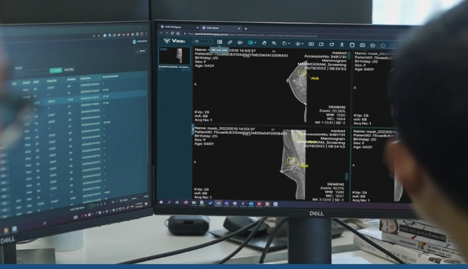 Sản phẩm AI cho chẩn đoán X-quang tuyến vú đầu tiên tại Việt Nam được FDA công nhận. Ảnh: VinBigdata